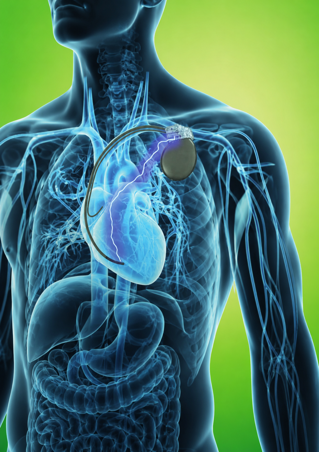 Stimulation cardiaque